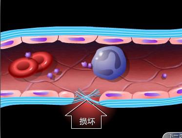 三维医学动画